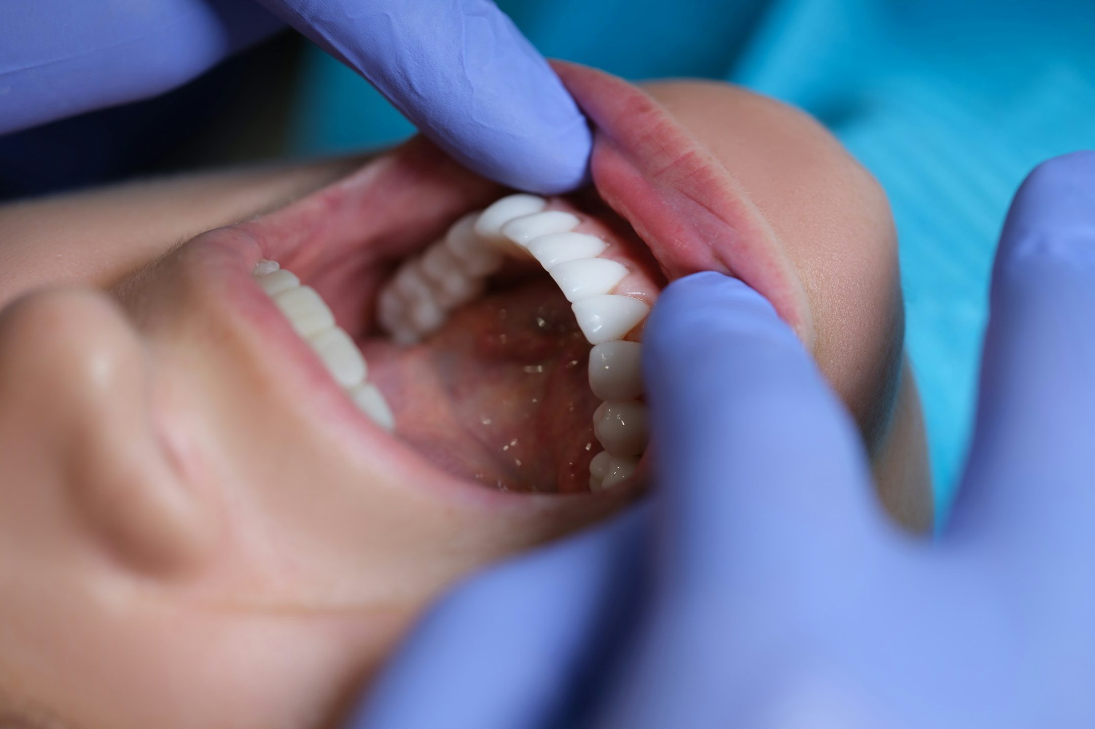 Odontopediatría - Dentista para niños Odontopediatría - Dentista para niños - Clínica dental infantil