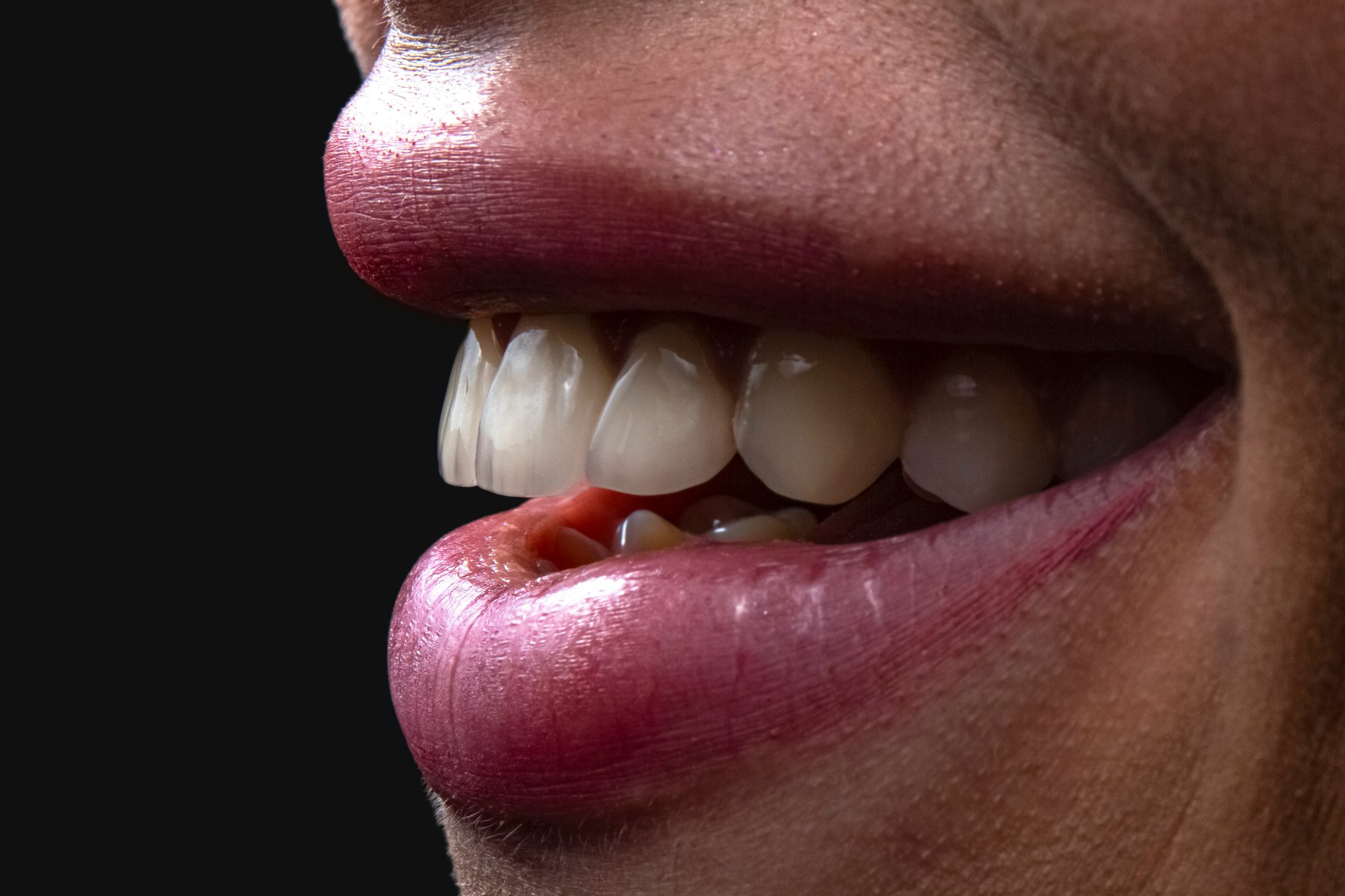 Odontología estética Dentista en Puebla - Oontología estética - Estética Dental en Puebla